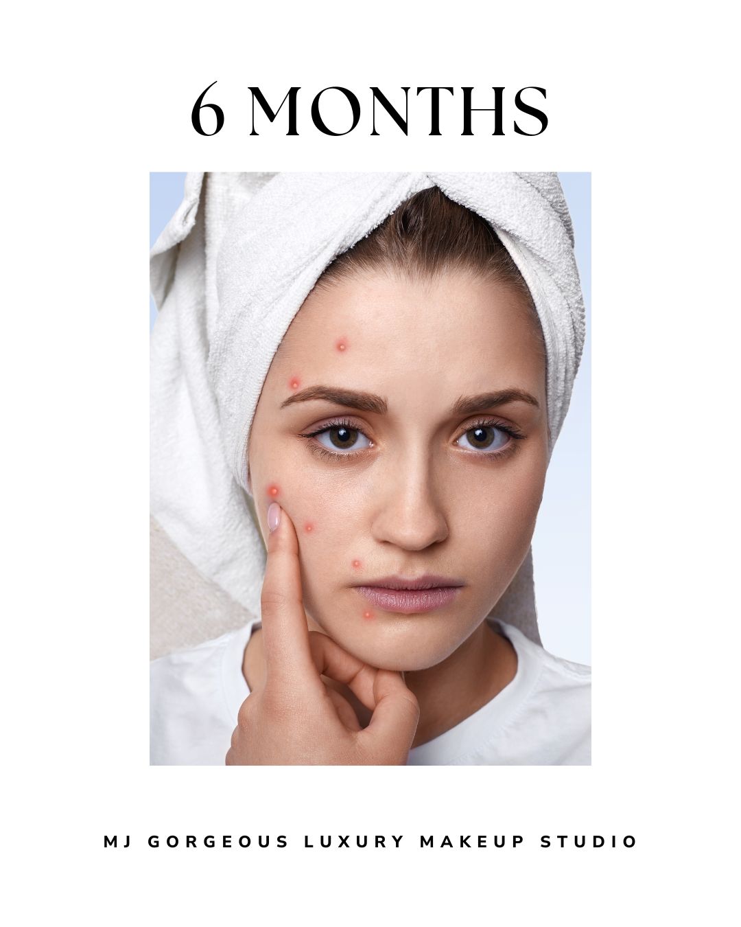 Six months skin prep