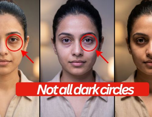Dark circles vs pigmentation vs shadow: the 60 second self test and what actually helps