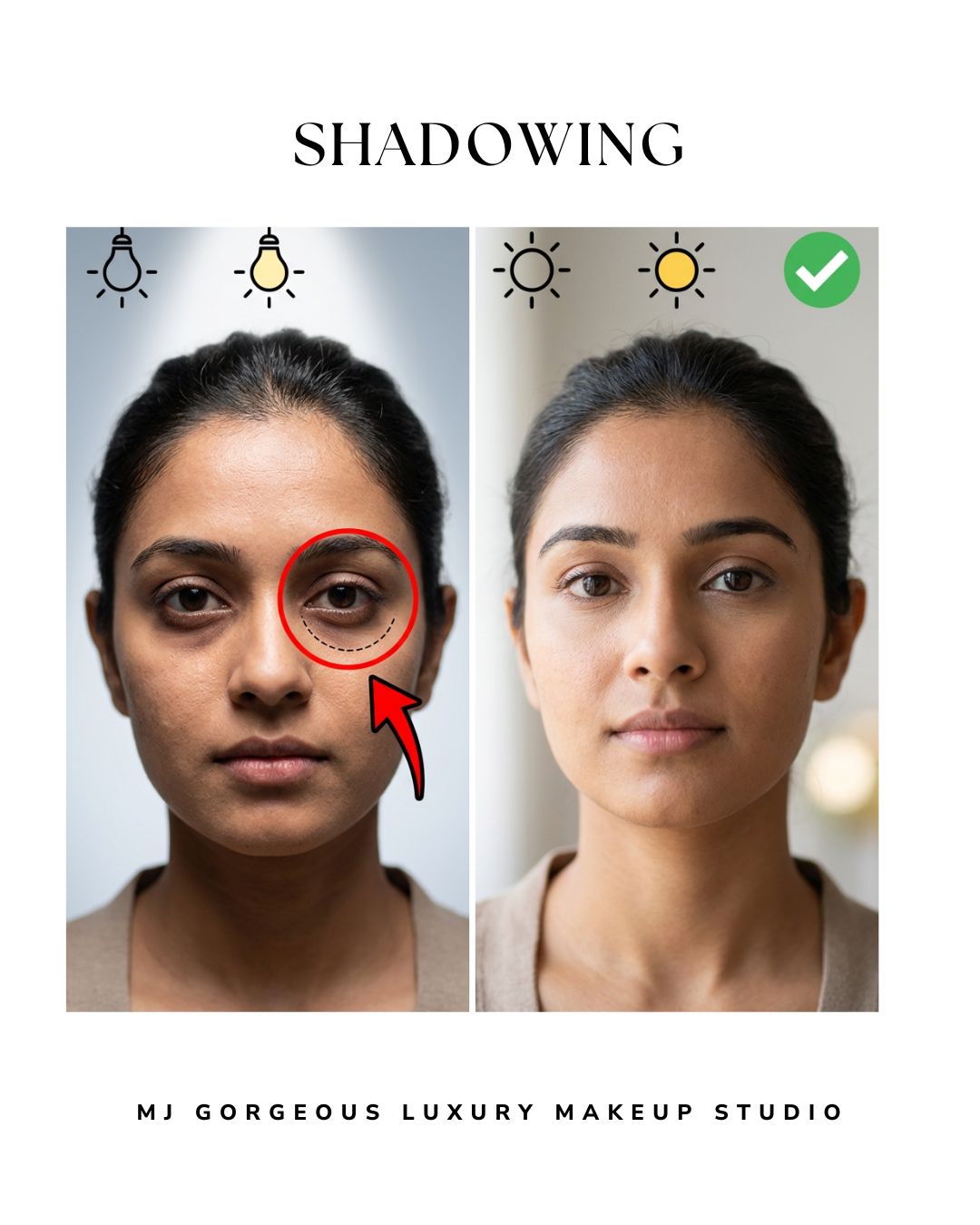 Under-eye shadowing facial structure example